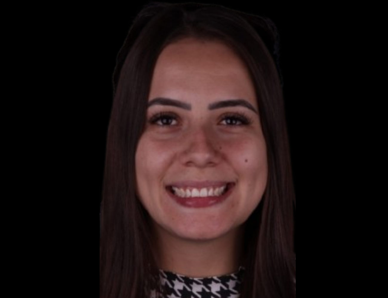 Mulher com sorriso renovado após aplicação de facetas de resina na clínica Dents Primer, em Catanduva, SP.