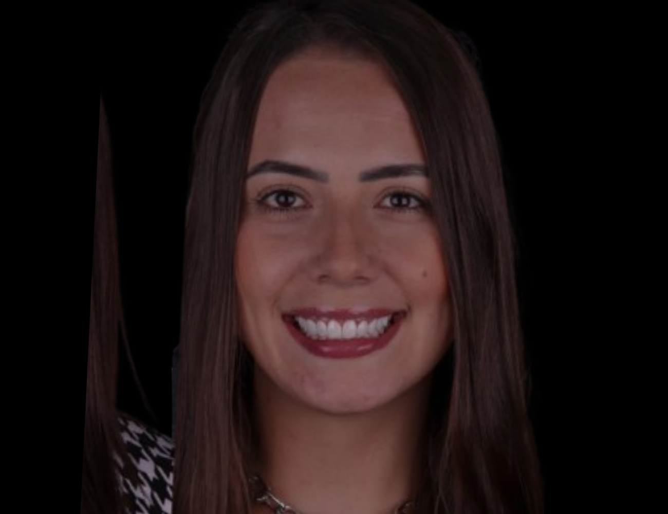 Mulher com sorriso renovado após aplicação de facetas de resina na clínica Dents Primer, em Catanduva, SP.