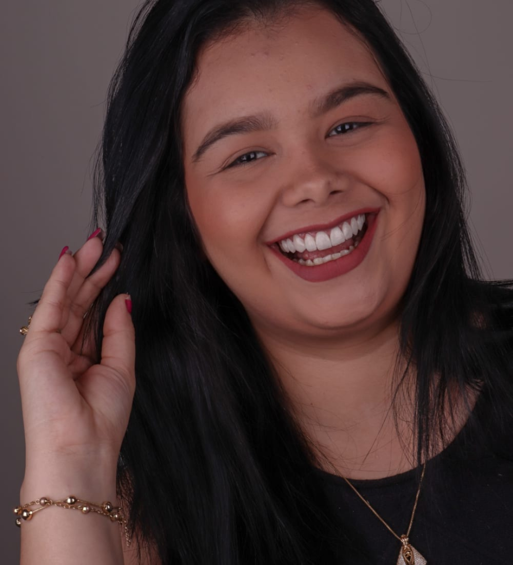 Mulher elogia o atendimento da Dra. Renata Terra e os resultados das facetas de resina realizadas na Dents Primer, em Catanduva, SP.