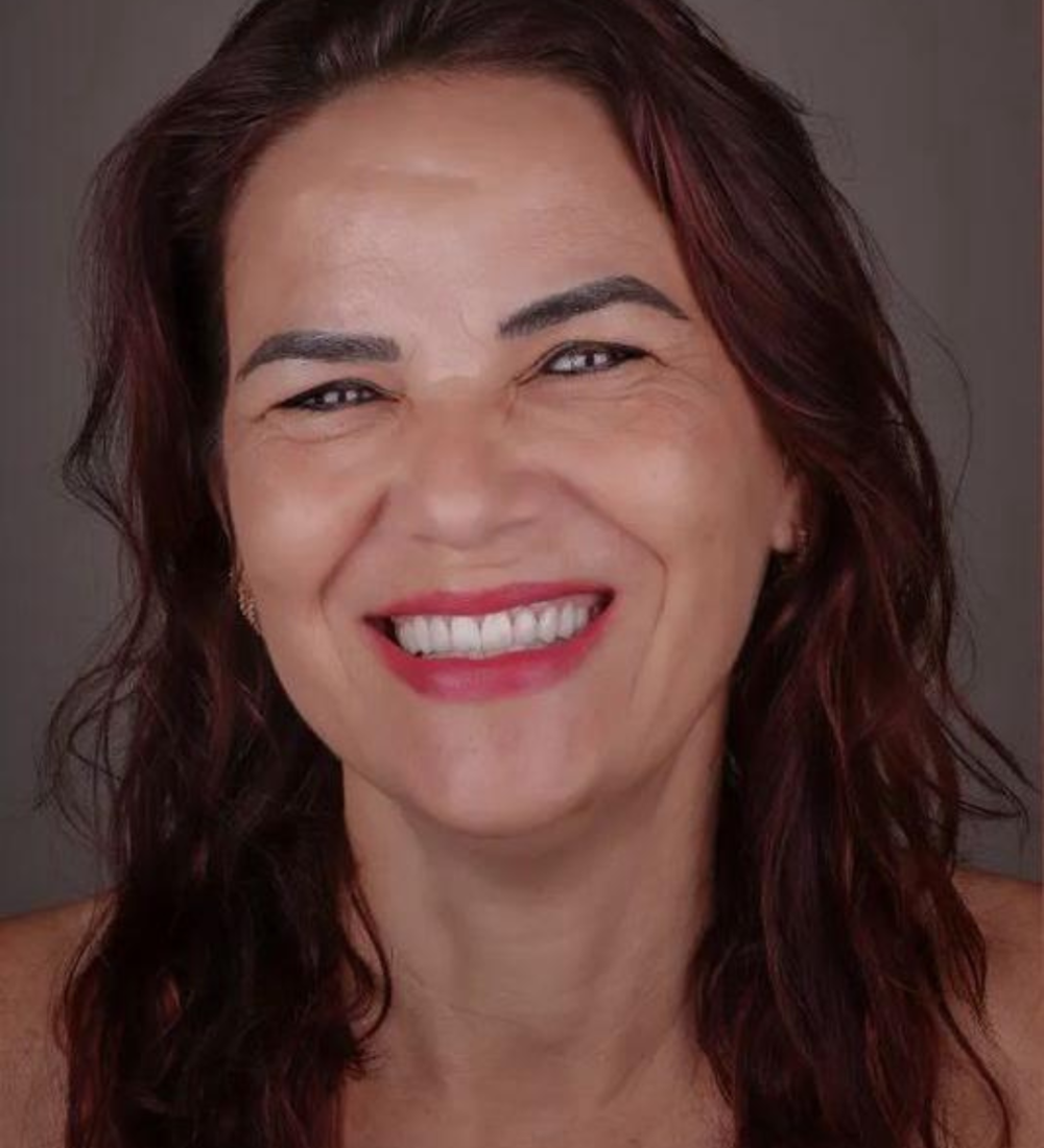 Mulher elogia o tratamento com facetas de resina realizado pela Dra. Renata Terra na clínica Dents Primer, em Catanduva, SP.